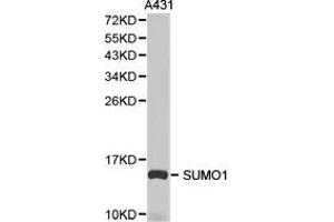 Western Blotting (WB) image for anti-Small Ubiquitin Related Modifier Protein 1 (SUMO1) antibody (ABIN1874993) (SUMO1 antibody)