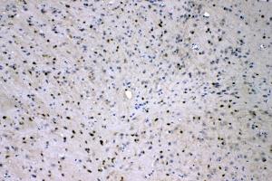 IHC analysis of ADO using anti-ADO antibody (ABIN4886431). (ADO antibody  (AA 49-261))