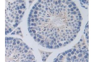 Immunohistochemistry (IHC) image for anti-Receptor Tyrosine-Protein Kinase ErbB-3 (ERBB3) (AA 707-964) antibody (ABIN7440773)
