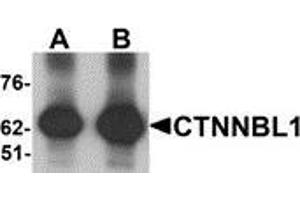 Western blot analysis of CTNNBL1 in human brain tissue lysate with CTNNBL1 antibody at (A) 1 and (B) 2 μg/ml. (CTNNBL1 antibody  (C-Term))