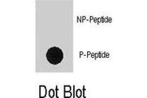 Dot blot analysis of RPS6KA1 (phospho S363) polyclonal antibody  on nitrocellulose membrane.