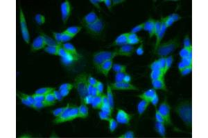 Immunofluorescent staining of SH-SY5Y cells (Second Panel). (CPE antibody  (AA 49-200))