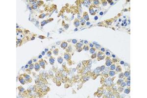 Immunohistochemistry (Paraffin-embedded Sections) (IHC (p)) image for anti-Polymerase (DNA Directed), gamma 2, Accessory Subunit (POLG2) antibody (ABIN7262585)