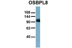 Host:  Rabbit  Target Name:  OSBPL8  Sample Type:  HT1080  Antibody Dilution:  1. (OSBPL8 antibody  (Middle Region))