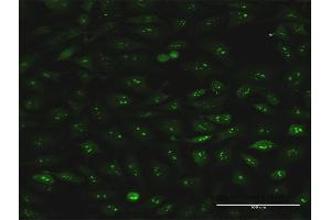 Immunofluorescence of monoclonal antibody to S100A7 on HeLa cell. (S100A7 antibody  (AA 1-101))