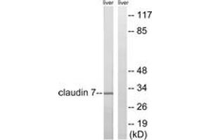 Western blot analysis of extracts from rat liver cells, using Claudin 7 (Ab-210) Antibody. (Claudin 7 antibody  (AA 162-211))