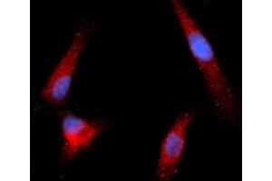 Immunofluorescence (IF) image for anti-Granzyme B (GZMB) (AA 21-247) antibody (APC) (ABIN5564760) (GZMB antibody  (AA 21-247) (APC))