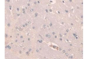 Detection of SCGN in Mouse Cerebrum Tissue using Polyclonal Antibody to Secretagogin (SCGN) (SCGN antibody  (AA 1-276))