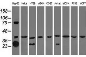 Western blot analysis of extracts (35 µg) from 9 different cell lines by using anti-QPRT monoclonal antibody. (QPRT antibody)