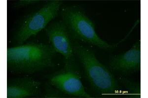 Immunofluorescence of monoclonal antibody to SNAI1 on U-2 OS cell. (SNAIL antibody  (AA 121-230))