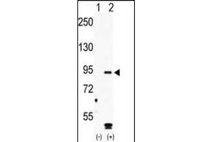 Western blot analysis of RK4 (arrow) using rabbit polyclonal hRK4- Antibody (ABIN391222 and ABIN2841295). (MARK4 antibody  (C-Term))