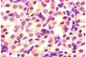 Immunohistochemistry of paraffin-embedded mouse kidney tissue using ABIN7176944 at dilution of 1:50 (Angiopoietin 2 antibody  (AA 19-483))