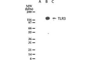 Western blot analysis of TLR3 in lysates from untransfected 293 cells (lane A), 293 cells transfected with human TLR3 cDNA (lane B), and 20 ug/lane human intestine tissue lysate (lane C). (TLR3 antibody  (AA 55-85))