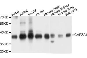 Western blot analysis of extracts of various cell lines, using CAPZA1 antibody (ABIN5971959) at 1/1000 dilution.