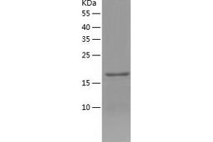 Western Blotting (WB) image for Glutathione Peroxidase 1 (GPX1) (AA 1-203) protein (His tag) (ABIN7285077) (Glutathione Peroxidase 1 Protein (GPX1) (AA 1-203) (His tag))