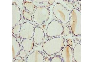 Immunohistochemistry of paraffin-embedded human thyroid tissue using ABIN7163421 at dilution of 1:100 (PSPH antibody  (AA 1-225))