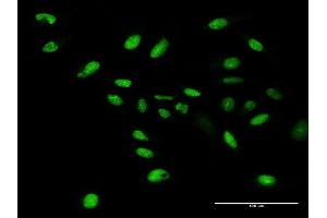 Immunofluorescence of purified MaxPab antibody to WDR4 on HeLa cell. (WDR4 antibody  (AA 1-412))