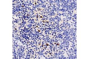 Immunohistochemistry of paraffin embedded mouse spleen using CXCR1 (ABIN7073465) at dilution of 1: 2000 (400x lens) (CXCR1 antibody)
