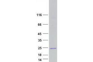 Validation with Western Blot