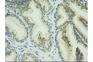 Immunohistochemical staining of paraffin-embedded Human prostate tissue using anti-C17orf28 mouse monoclonal antibody. (HID1/DMC1 antibody)