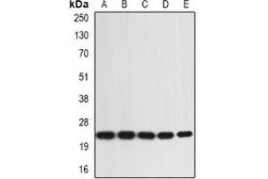 Western blot analysis of IL-36A expression in SW480 (A), A431 (B), mouse skin (C), mouse heart (D), rat liver (E) whole cell lysates.
