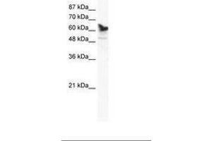 Image no. 1 for anti-DEAD (Asp-Glu-Ala-Asp) Box Polypeptide 41 (DDX41) (AA 447-496) antibody (ABIN202831) (DDX41 antibody  (AA 447-496))