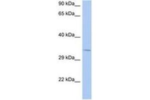 Image no. 1 for anti-N-Ethylmaleimide Sensitive Fusion Protein Attachment Protein beta (NAPB) (N-Term) antibody (ABIN6744372) (NAPB antibody  (N-Term))