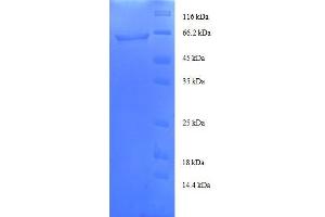 Transaldolase 1 (TALDO1) (AA 9-337), (partial) protein (GST tag) (TALDO1 Protein (AA 9-337, partial) (GST tag))