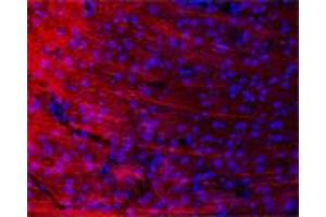 IF (confocal) on rat brain at a concentration of 30 µg/ml using Rabbit antibody to rat, mouse Mtap2 (Microtubule-associated protein 2, MAP-2, MAP 2, MAP2, MAP2R): IgG (ABIN350476), DAPI counterstained. (MAP2 antibody  (AA 350-400))