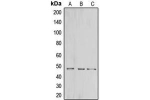 Western blot analysis of CNPase expression in HeLa (A), mouse brain (B), rat brain (C) whole cell lysates. (Cnpase antibody  (Center))