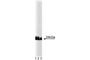 Western blot analysis of caveolin-1 (pY14) on lysates from A431 cells (Human epithelial carcinoma, ATCC CRL-1555) treated with 100 ng/mL EGF. (Caveolin antibody  (pTyr14))