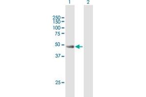 Western Blot analysis of CYLC2 expression in transfected 293T cell line by CYLC2 MaxPab polyclonal antibody. (CYLC2 antibody  (AA 1-348))