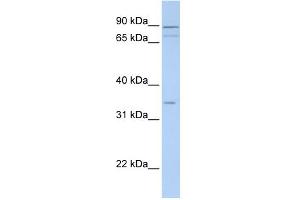WB Suggested Anti-TNMD Antibody Titration:  0. (TNMD antibody  (Middle Region))