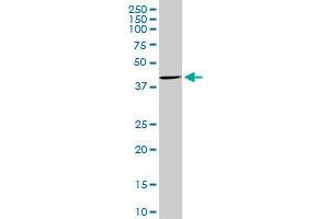 CDX4 monoclonal antibody (M16), clone 1E11. (CDX4 antibody  (AA 202-284))