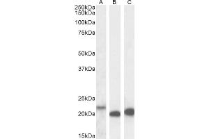 (ABIN570987) (0. (IL-18 antibody  (Internal Region))