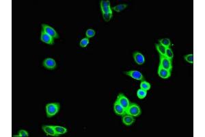 Immunofluorescent analysis of HepG2 cells using ABIN7154928 at dilution of 1:100 and Alexa Fluor 488-congugated AffiniPure Goat Anti-Rabbit IgG(H+L) (GUCY2C antibody  (AA 636-891))