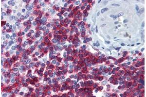 Human Spleen: Formalin-Fixed, Paraffin-Embedded (FFPE) (CD247 antibody  (AA 1-165))