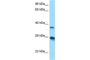 Host:  Rabbit  Target Name:  VSIG4  Sample Tissue:  Human COLO205 Whole Cell  Antibody Dilution:  1ug/ml (VSIG4 antibody  (N-Term))