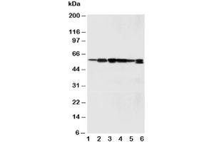 Western blot testing of SSH3BP1 antibody and Lane 1:  rat liver