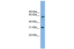 WB Suggested Anti-MITD1 Antibody Titration: 0. (MITD1 antibody  (Middle Region))