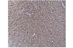 IHC analysis of Alpha Internexin/INA using anti-Alpha Internexin/INA antibody (ABIN7602187).