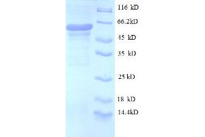 OGT Protein (AA 606-1022, partial) (His-SUMO Tag)