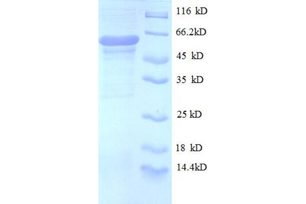 OGT Protein (AA 606-1022, partial) (His-SUMO Tag)