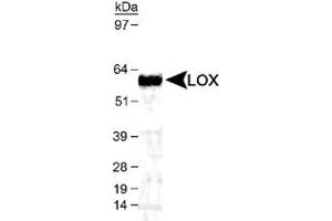 Western blot analysis of LOX in mouse kidney lysate using LOX polyclonal antibody  (1 : 1,000). (LOX antibody  (AA 200-300, AA 300-400))