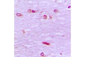 Immunohistochemical analysis of BRF1 staining in human brain formalin fixed paraffin embedded tissue section. (BRF1 antibody  (Center))