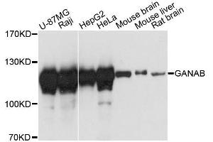Western blot analysis of extracts of various cell lines, using GANAB antibody. (GANAB antibody  (AA 1-260))