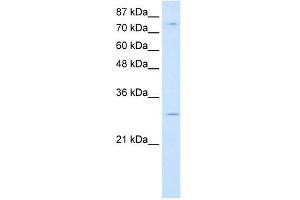 RBM28 antibody used at 0. (RBM28 antibody  (C-Term))