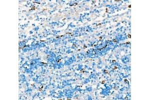 IHC analysis of CD68 using anti-CD68 antibody (ABIN7600142). (CD68 antibody  (AA 154-354))