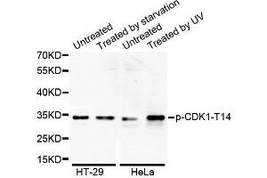Western Blotting (WB) image for anti-Cyclin-Dependent Kinase 1 (CDK1) (pThr14) antibody (ABIN1870047) (CDK1 antibody  (pThr14))
