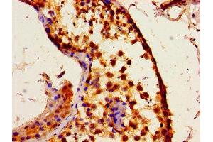 Immunohistochemistry of paraffin-embedded human testis tissue using ABIN7156293 at dilution of 1:100 (ITPR1 antibody  (AA 1707-1966))